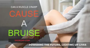 Muscle Cramps: Can They Cause Bruising?
