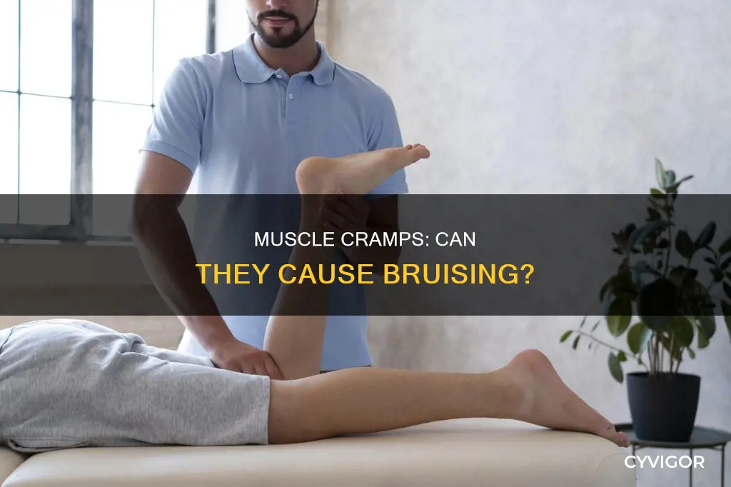 can a muscle cramp cause a bruise