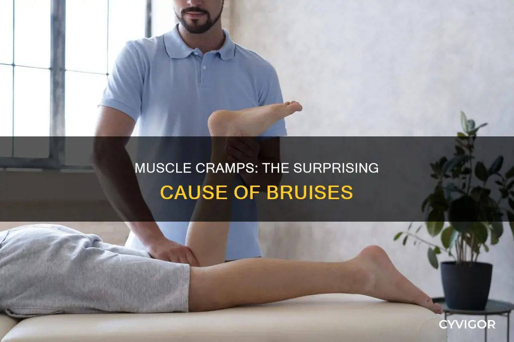 can a muscle cramp cause bruising