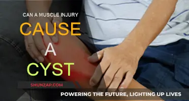 Muscle Injuries: Cysts and What You Need to Know