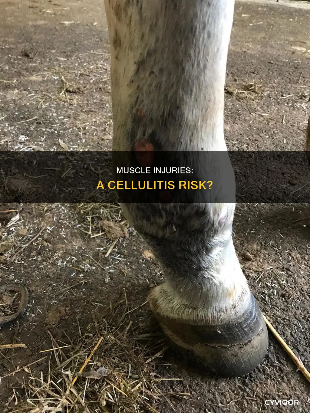 can a muscle injury cause cellulitis