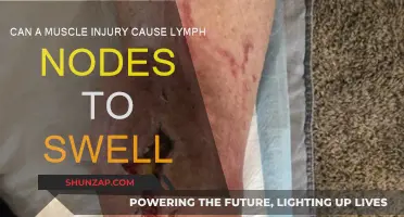 Muscle Injuries: Can They Cause Swollen Lymph Nodes?
