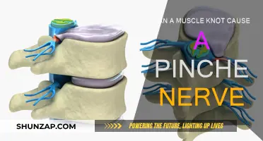 Muscle Knots and Pinched Nerves: What's the Connection?