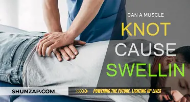 Muscle Knots: Can They Cause Swelling?