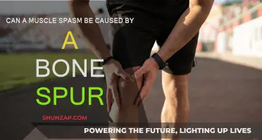 Bone Spurs: A Surprising Cause of Muscle Spasms?