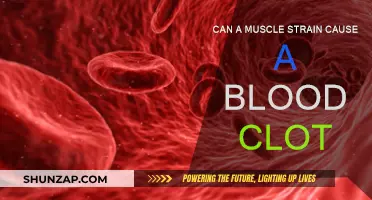 Muscle Strains: A Surprising Cause of Blood Clots?