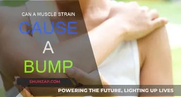 Muscle Strain: Why a Bump May Appear