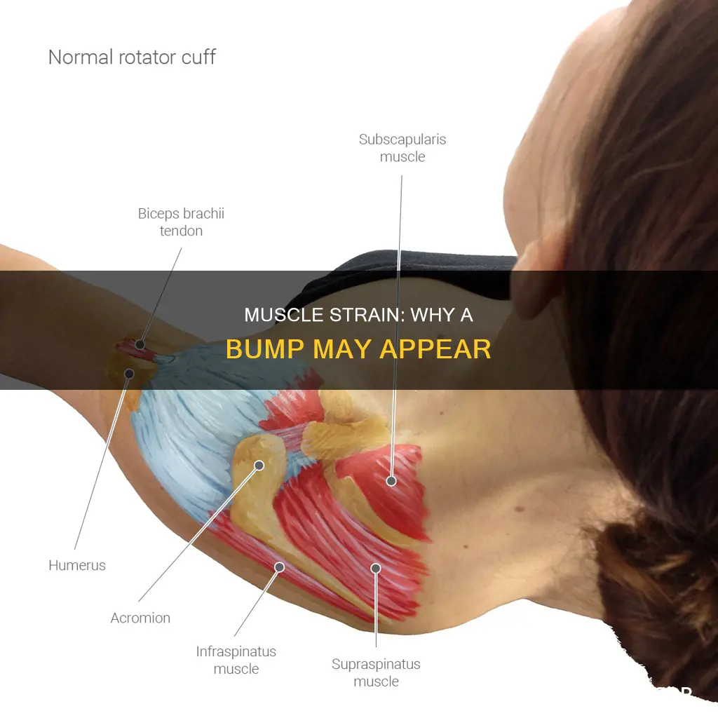 can a muscle strain cause a bump