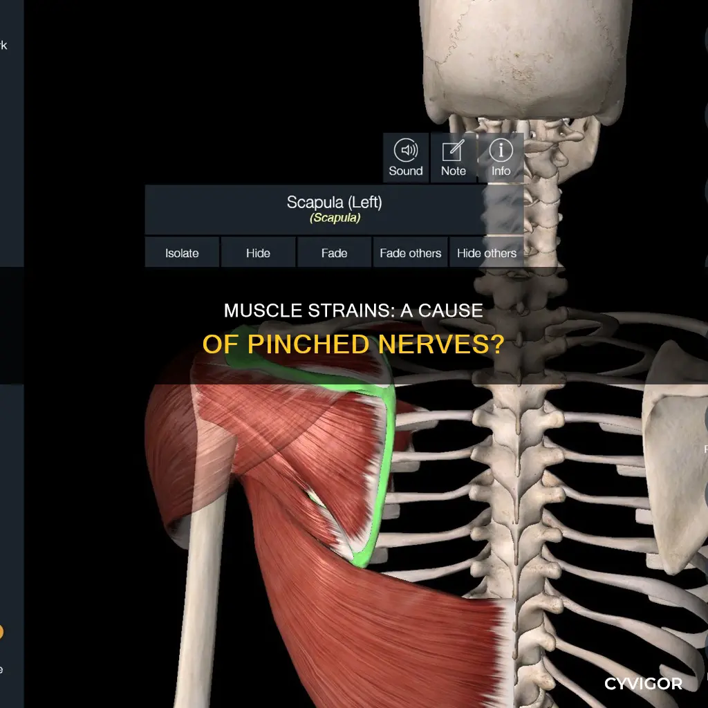 can a muscle strain cause a pinched nerve