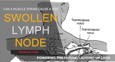 Muscle Strain and Lymph Nodes: What's the Connection?