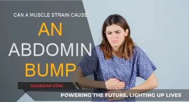 Muscle Strain: Can It Cause an Abdominal Bump?