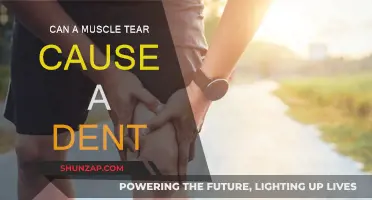 Muscle Tears: Can They Cause Dent Impressions?