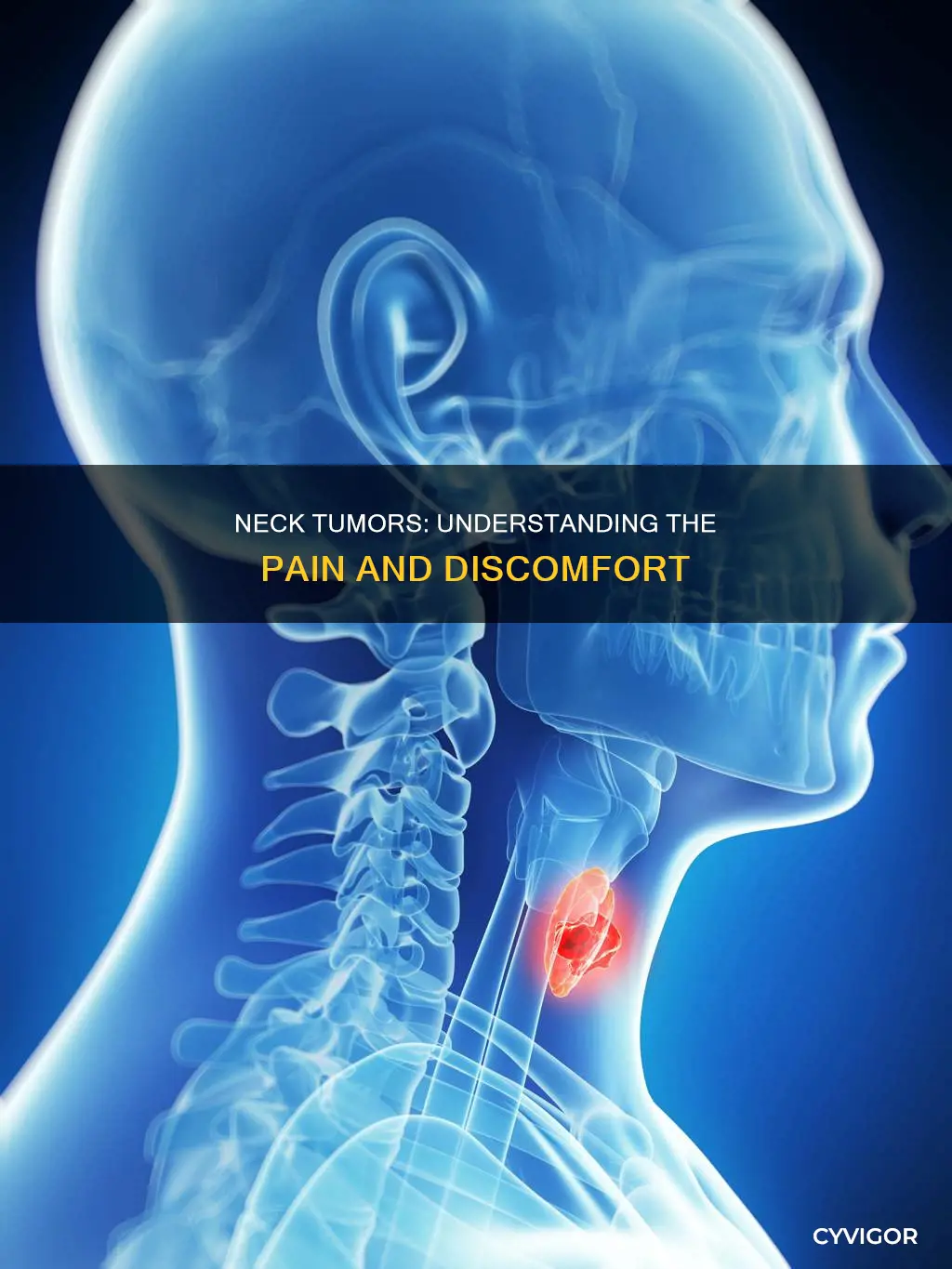 can a neck tumor cause pain in neck muscle