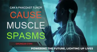 Pancoast Tumor and Muscle Spasms: Is There a Link?