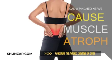 Pinched Nerve: Muscle Atrophy and Treatment Options