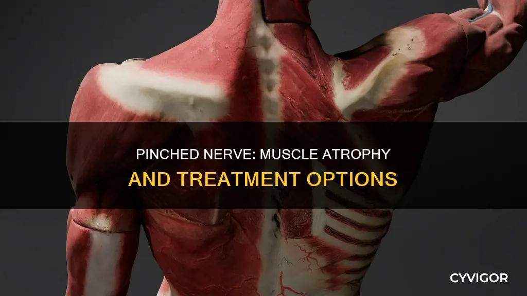 can a pinched nerve cause muscle atrophy