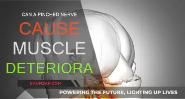 Pinched Nerve: Muscle Deterioration and Treatment