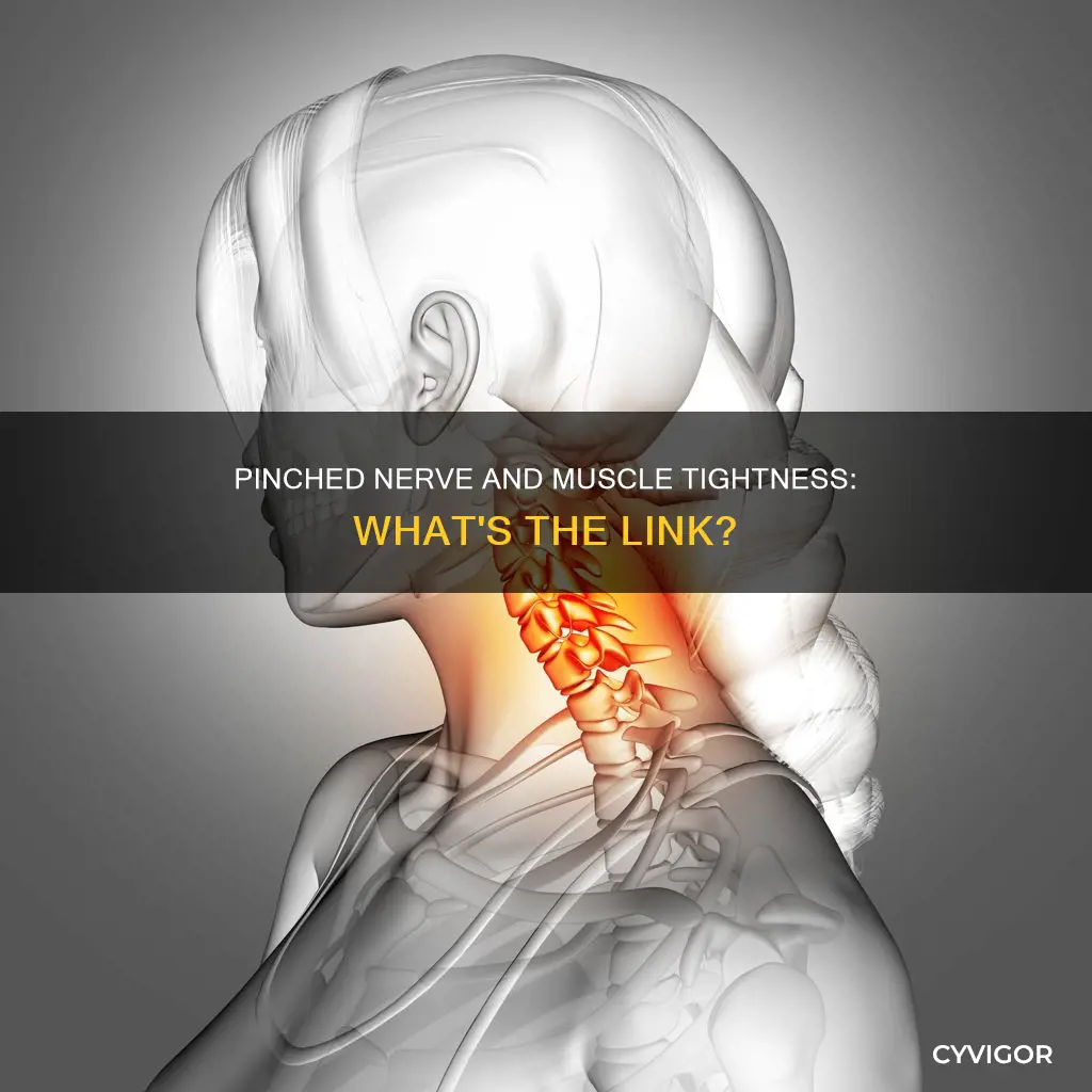 Pinched Nerve And Muscle Tightness: What's The Link? | CyVigor