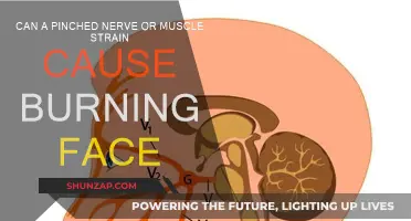 Burning Face: Pinched Nerve or Muscle Strain?