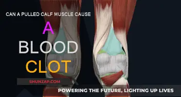 Pulled Calf Muscle: Could It Cause Blood Clots?