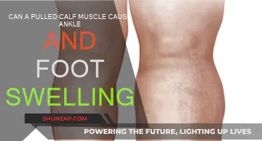 Pulled Calf Muscle: Ankle and Foot Swelling?