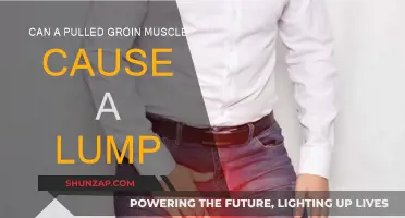 Groin Injury: Lump a Sign of Pulled Muscle?