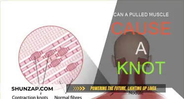 Pulled Muscle and Knots: What's the Connection?
