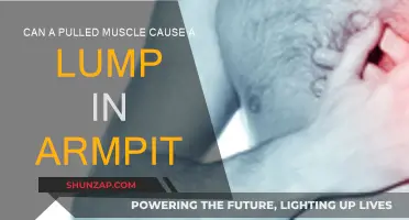 Pulled Muscle and Armpit Lump: What's the Connection?