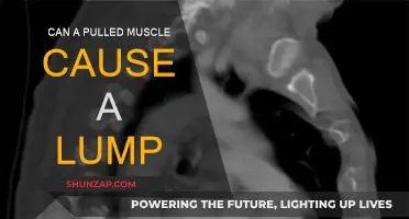 Pulled Muscle and Lumps: What's the Connection?
