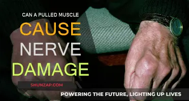 Pulled Muscles: Nerve Damage or Just Pain?