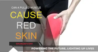 Pulled Muscle and Red Skin: What's the Link?