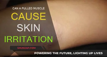 Pulled Muscles: Skin Irritation or Something More?