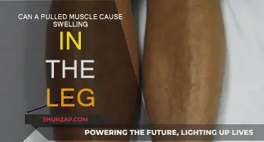 Pulled Muscle Leg Swelling: What You Need to Know