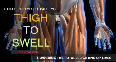 Pulled Muscle Swelling: When Thigh Pain Leads to Swelling