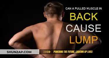 Back Muscle Pull: Can It Cause a Lump?