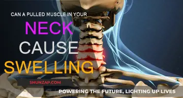 Neck Muscle Pull: Understanding Swelling and Treatment