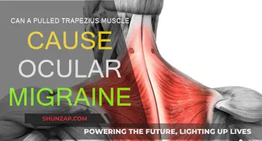 Trapezius Muscle and Ocular Migraines: Is There a Link?