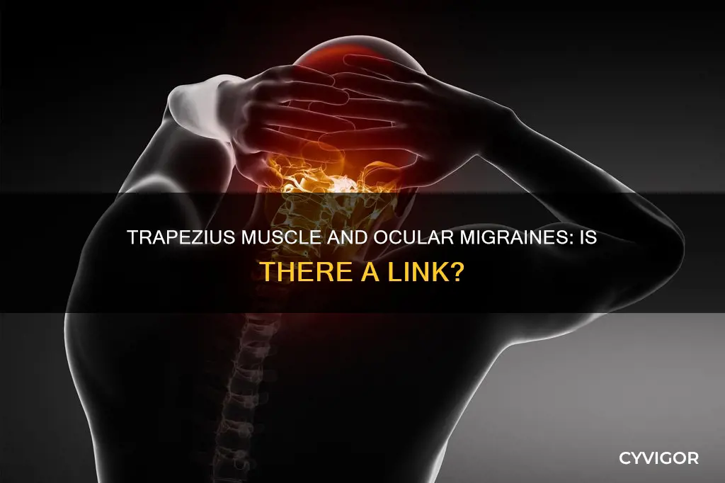 can a pulled trapezius muscle cause ocular migraines