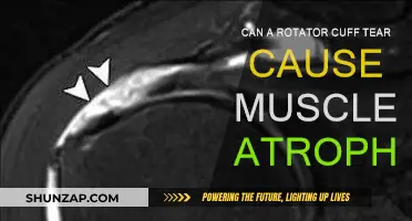 Rotator Cuff Tears: Muscle Atrophy and Recovery