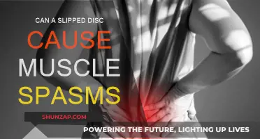 Slipped Disc: Muscle Spasms and Their Connection