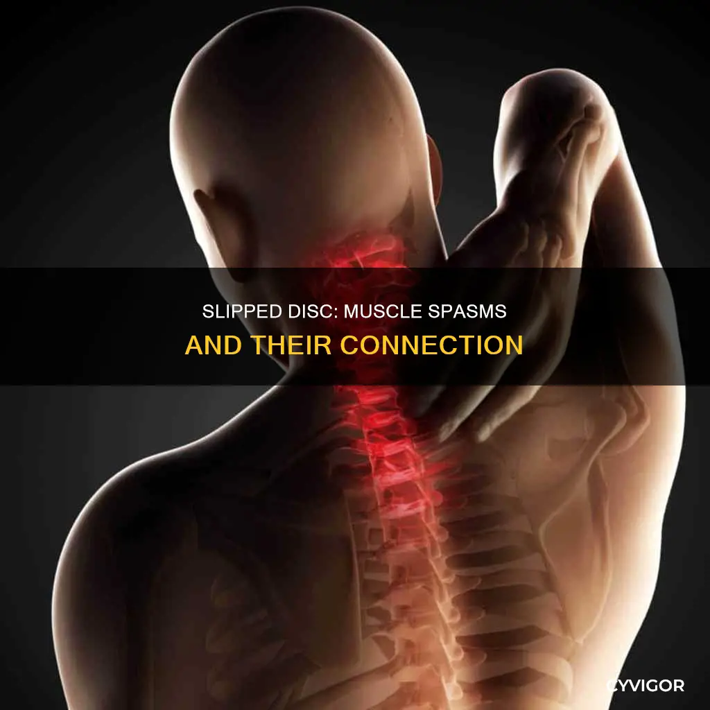 can a slipped disc cause muscle spasms