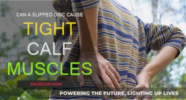 Slipped Disc: How Does It Affect Calf Muscle Tightness?