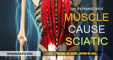 Back Muscle Strain: A Cause of Sciatica?