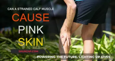 Calf Strain: Why Your Skin Turns Pink