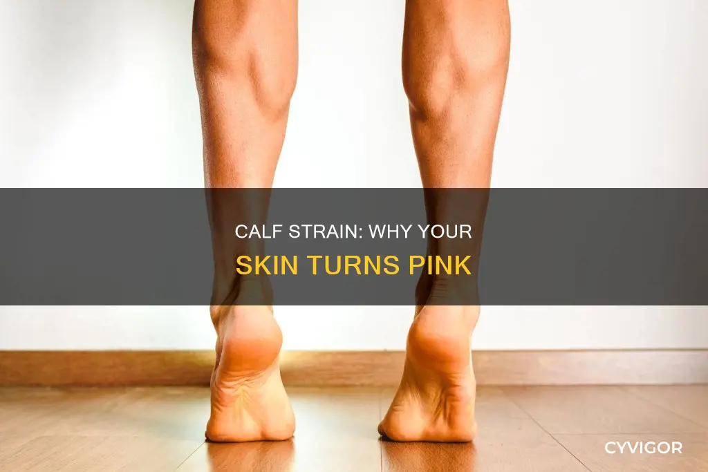 can a strained calf muscle cause pink skin