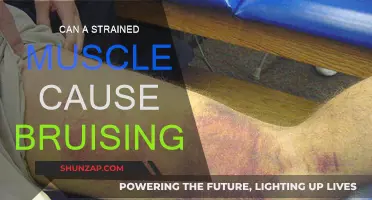 Muscle Strain: Why Bruising is a Common Symptom