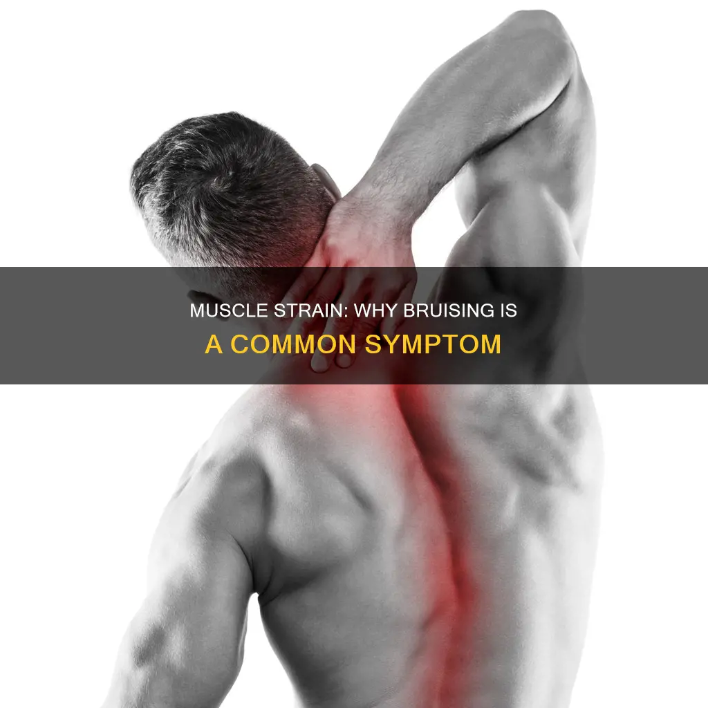 can a strained muscle cause bruising