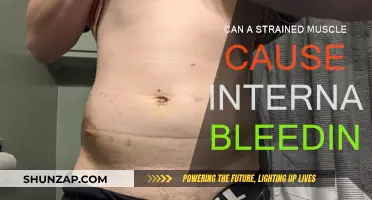 Muscle Strains: Internal Bleeding Risk and Causes