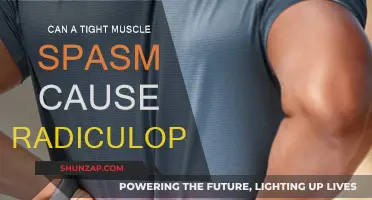Tight Muscles and Radiculopathy: What's the Link?