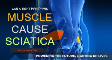 Piriformis Syndrome: A Cause of Sciatica?